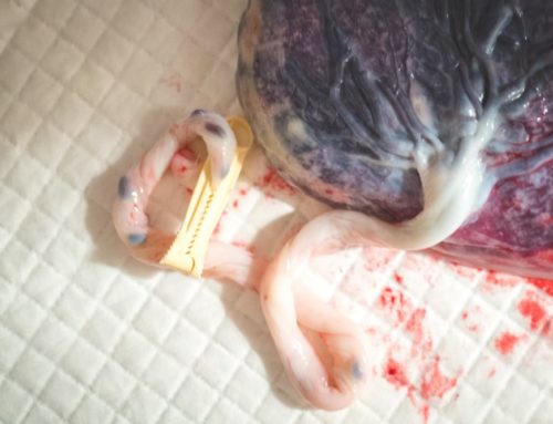 Geburtsfotografie und natürliche Fotos im frühen Wochenbett